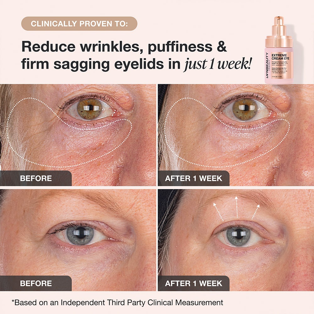 InnBeauty Extreme Eye